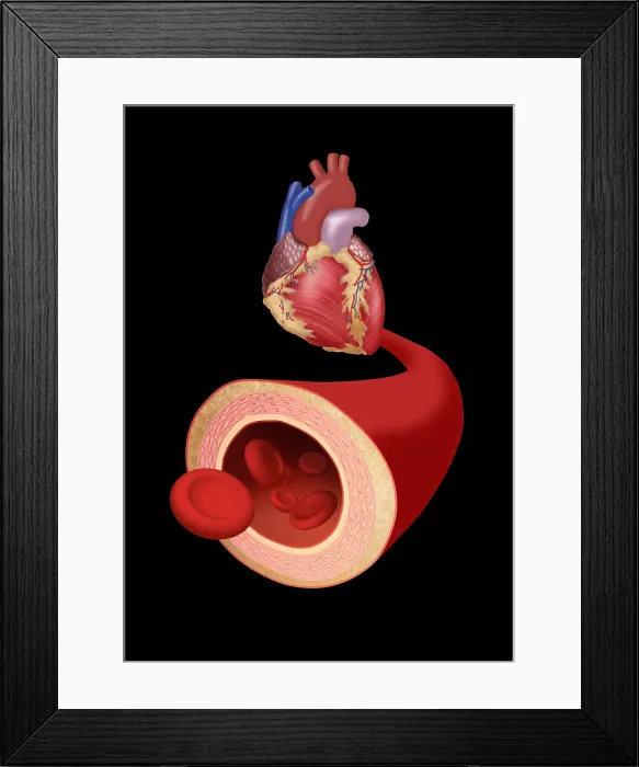 Framed Print : Heart and Artery Framed Print : Heart and Artery