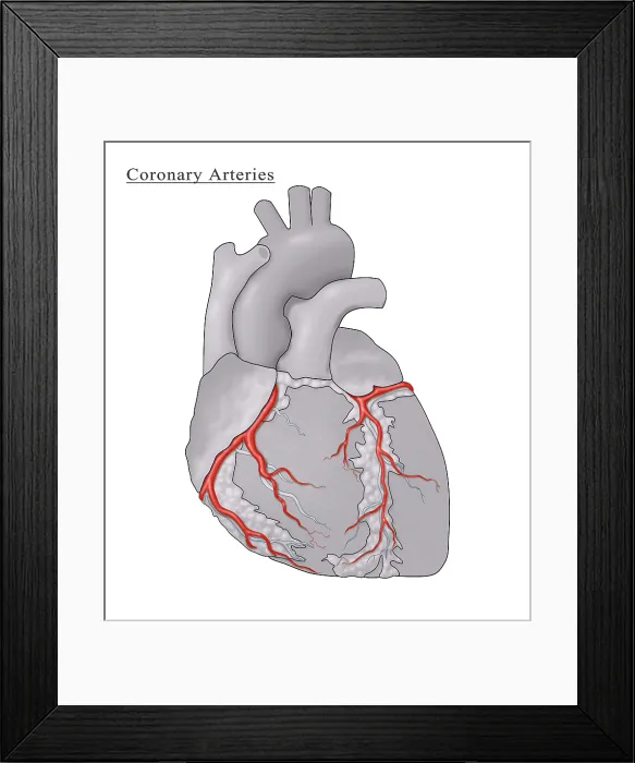 Framed Print : Coronary Arteries, Illustration