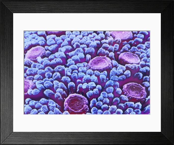 Framed Print : Surface of tongue Framed Print : Surface of tongue