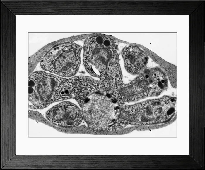 Framed Print : Malaria, Plasmodium cathemerium, TEM Framed Print : Malaria, Plasmodium cathemerium, TEM