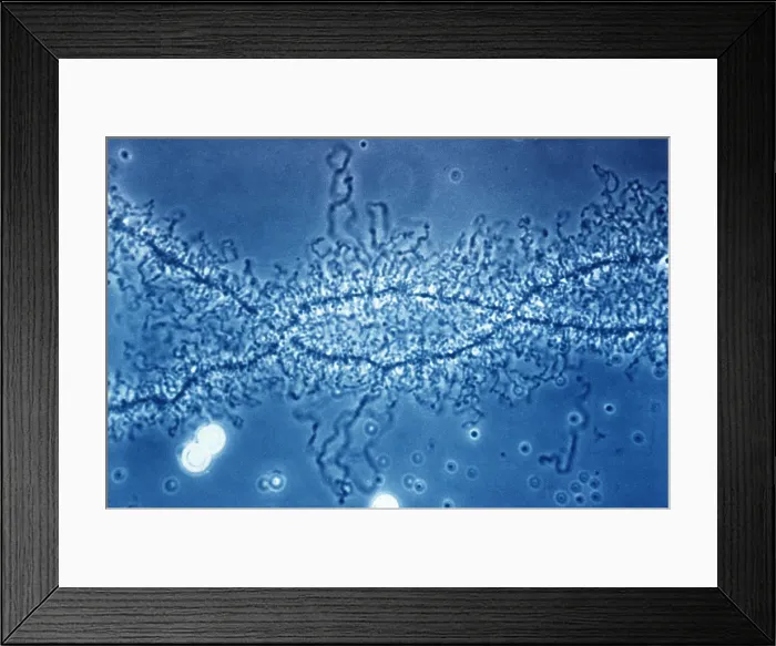 Framed Print : Lampbrush Chromosome Framed Print : Lampbrush Chromosome