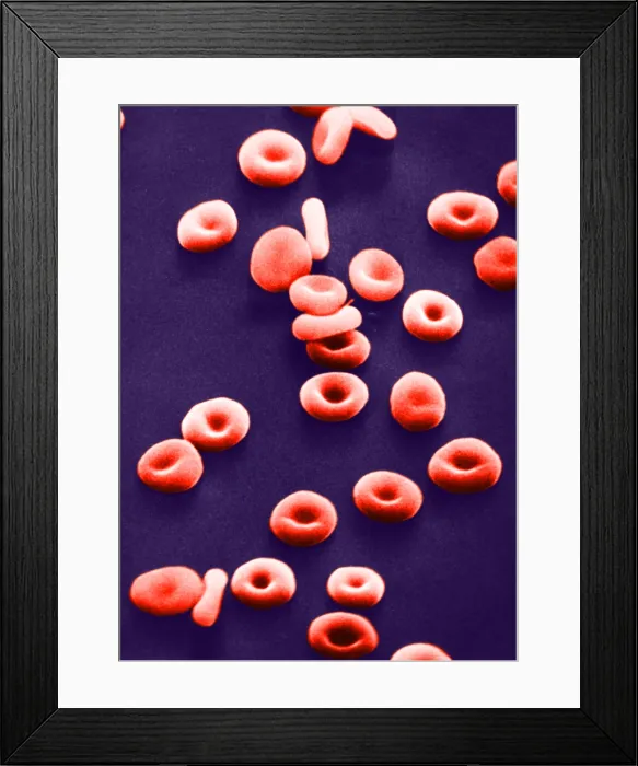 Framed Print : Red Blood Cells, under a microscope (SEM) Framed Print : Red Blood Cells, under a microscope (SEM)