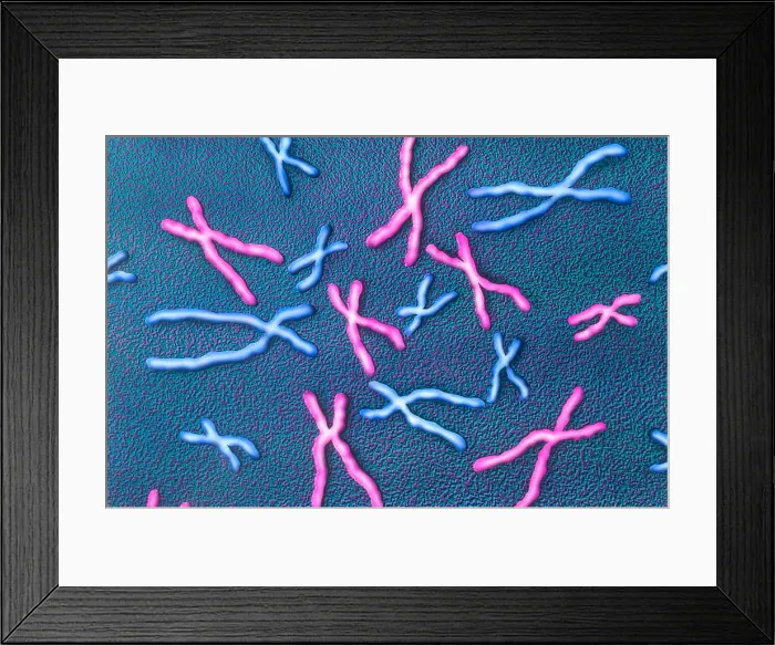Framed Print : Metaphase Chromosomes Framed Print : Metaphase Chromosomes