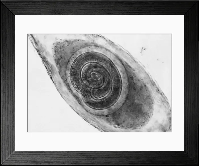 Framed Print : Trichinella in Muscle (LM) under a microscope