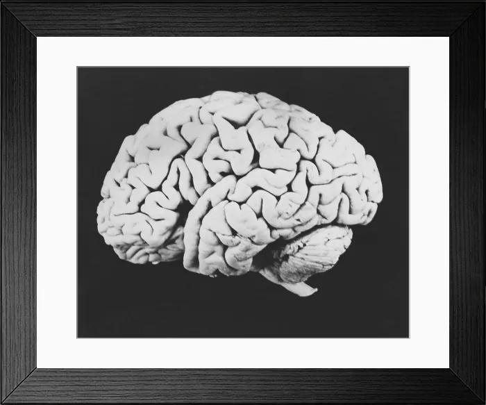 Framed Print : Human brain Framed Print : Human brain