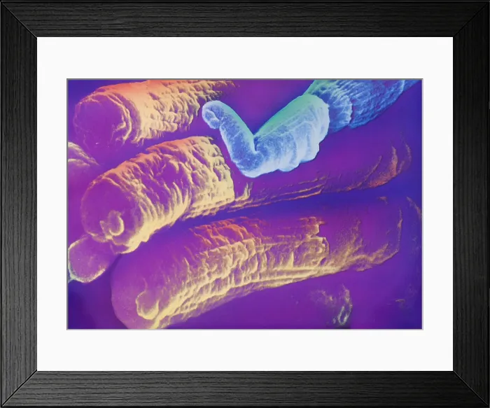 Framed Print : Rods and Cones, under a microscope (SEM) Framed Print : Rods and Cones, under a microscope (SEM)