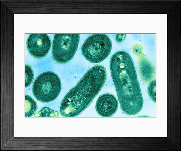 Framed Print : Blue-Green Algae, TEM Framed Print : Blue-Green Algae, TEM