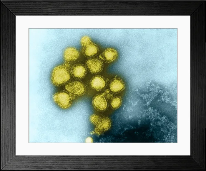 Framed Print : Influenza Virus Framed Print : Influenza Virus
