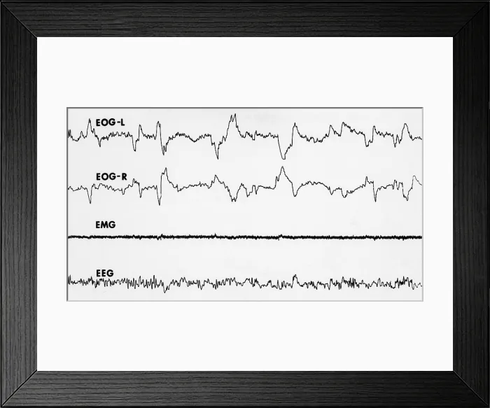 Framed Print : Polygraph Tracings of REM Sleep Framed Print : Polygraph Tracings of REM Sleep