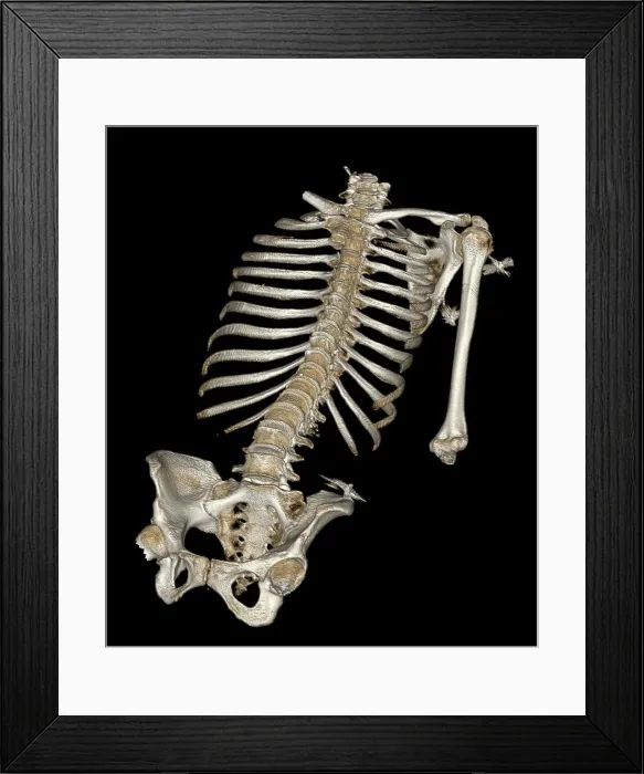 Framed Print : Skeletal Reconstruction Framed Print : Skeletal Reconstruction