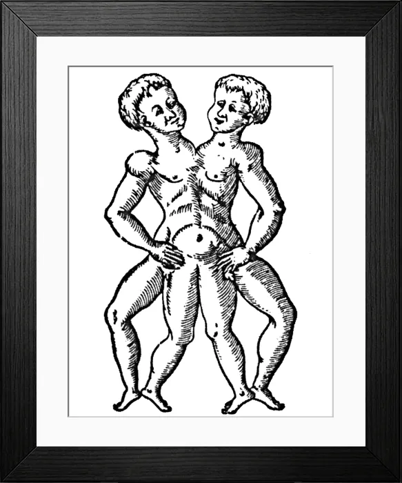 Framed Print : Conjoined Twins, 16th Century Framed Print : Conjoined Twins, 16th Century