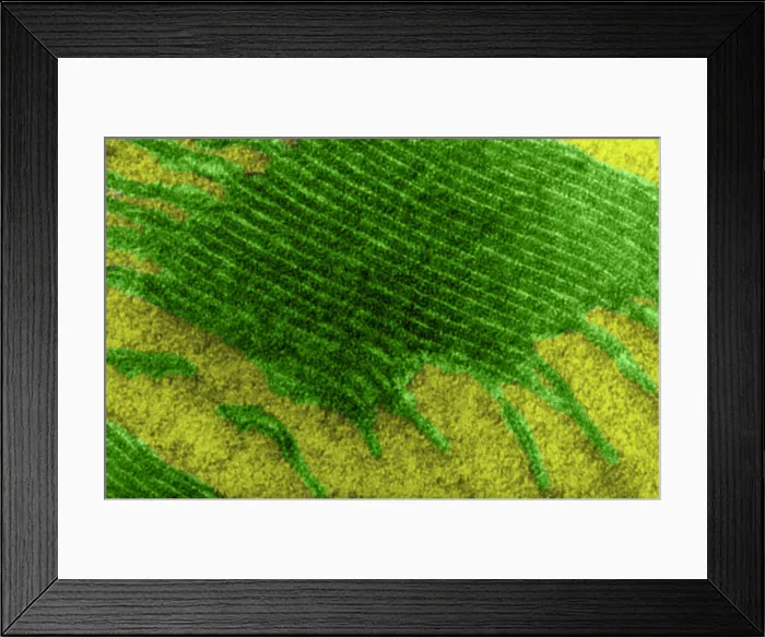 Framed Print : Chloroplast, TEM Framed Print : Chloroplast, TEM