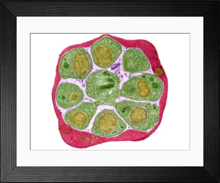 Framed Print : Red blood cell Infected with Malarial Parasite, under a transmission electron microscope TEM Framed Print : Red blood cell Infected with Malarial Parasite, under a transmission electron microscope TEM