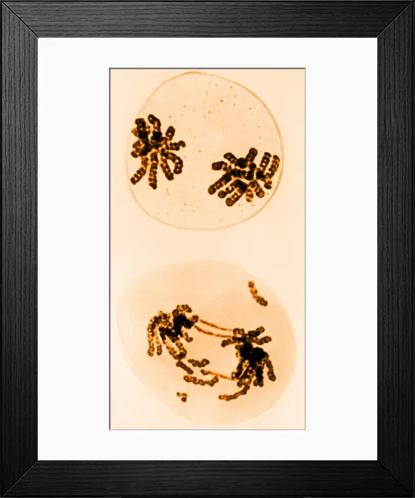 Framed Print : Chromosomes, Radiation Damage, TEM Framed Print : Chromosomes, Radiation Damage, TEM