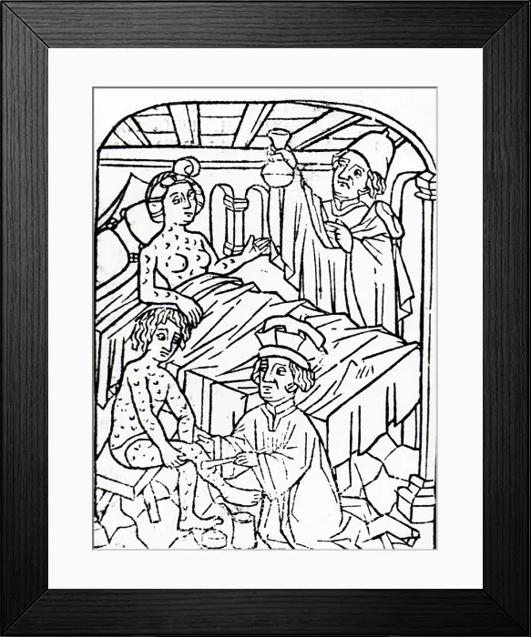 Framed Print : Uroscopy, Patients with Syphilis, 1497 Framed Print : Uroscopy, Patients with Syphilis, 1497