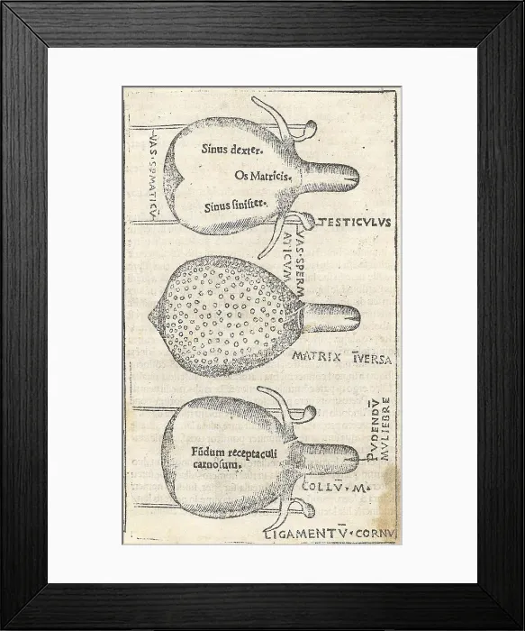 Framed Print : Historical Anatomical Illustration