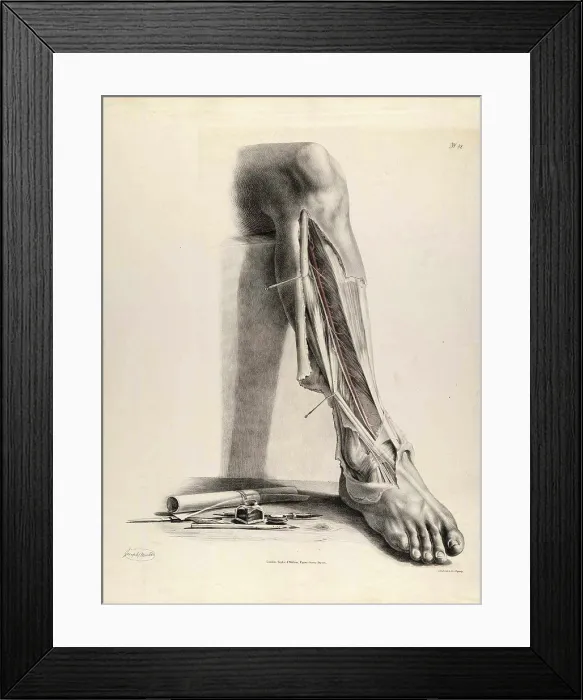Framed Print : Historical Anatomical Illustration Framed Print : Historical Anatomical Illustration