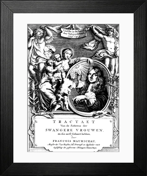 Framed Print : Francois Mauriceau, French Obstetrician Framed Print : Francois Mauriceau, French Obstetrician