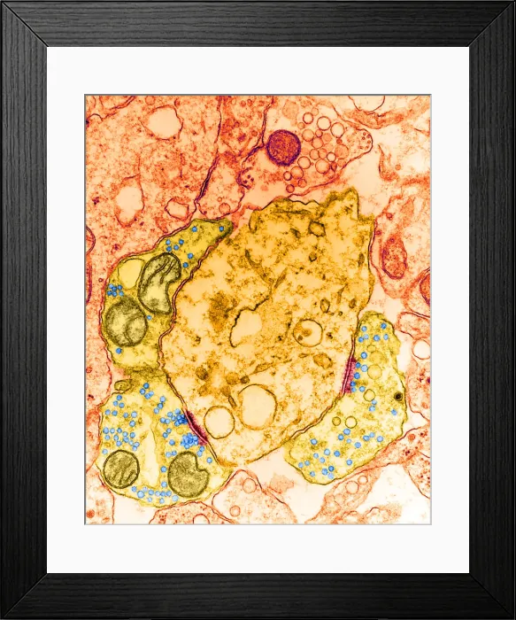 Framed Print : Synapse, TEM Framed Print : Synapse, TEM