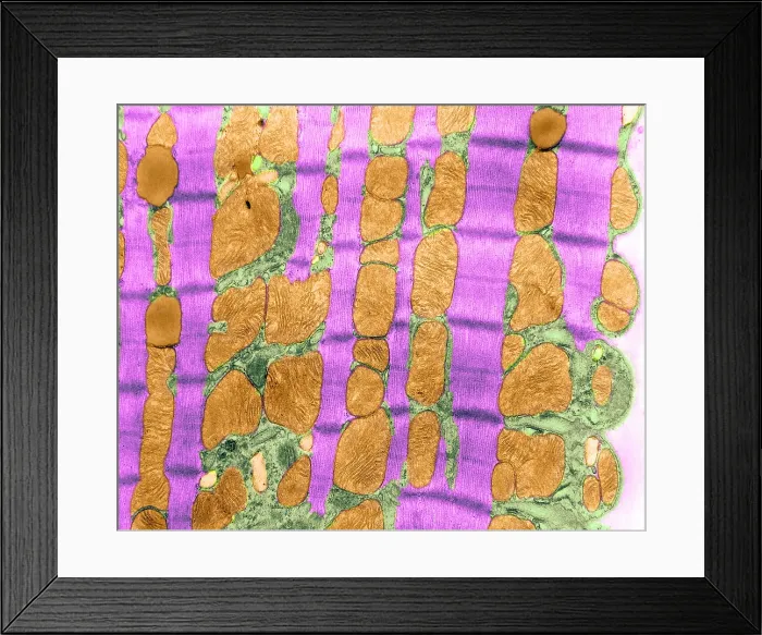 Framed Print : Cardiac Muscle, TEM Framed Print : Cardiac Muscle, TEM