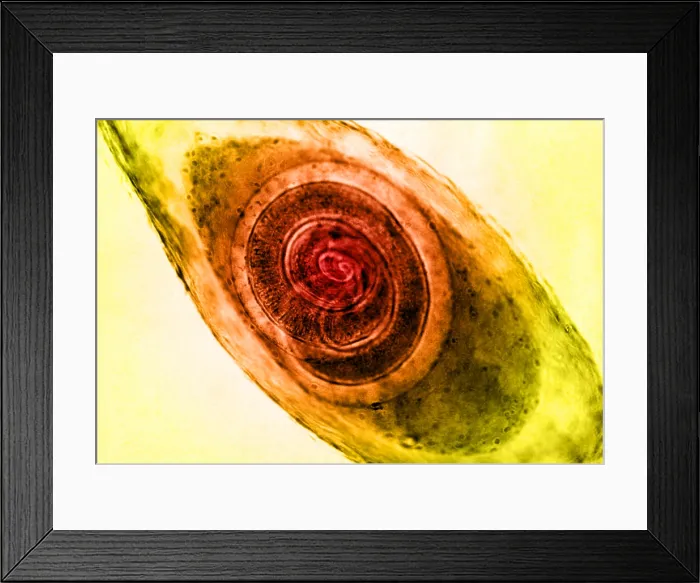 Framed Print : Trichinella in Muscle, light micrograph Framed Print : Trichinella in Muscle, light micrograph