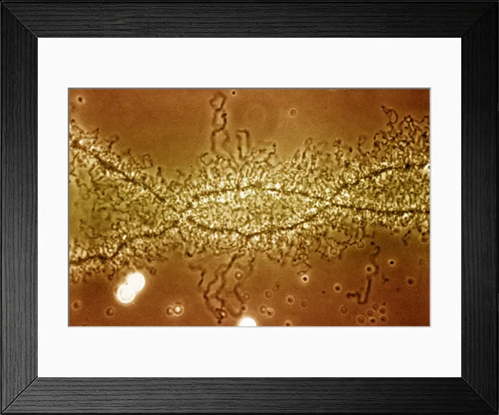 Framed Print : Lampbrush Chromosome Framed Print : Lampbrush Chromosome