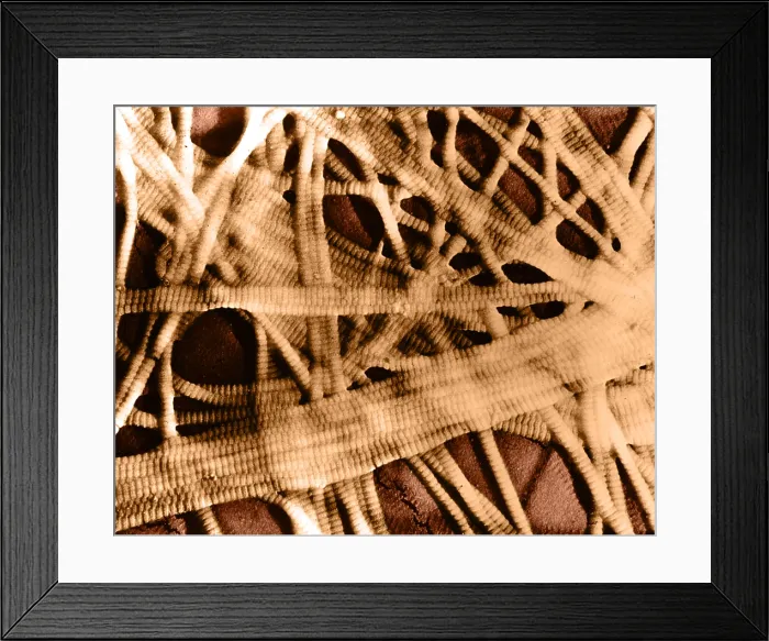 Framed Print : Integumentary System, Subcutaneous Tissue, TEM Framed Print : Integumentary System, Subcutaneous Tissue, TEM
