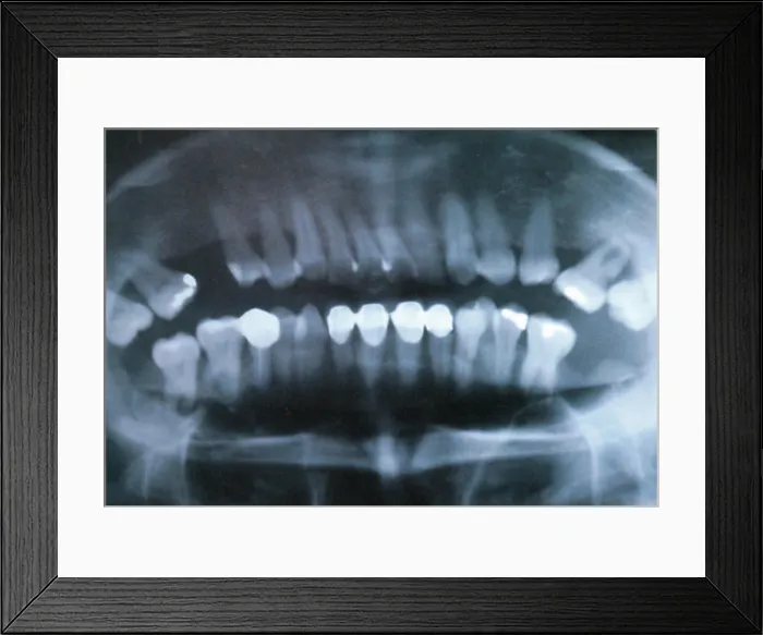 Framed Print : Panoramic Dental X-Ray Framed Print : Panoramic Dental X-Ray