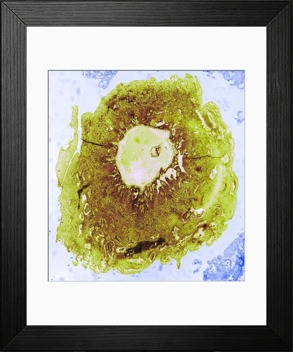 Framed Print : Reproduction System, Human Ovum, TEM