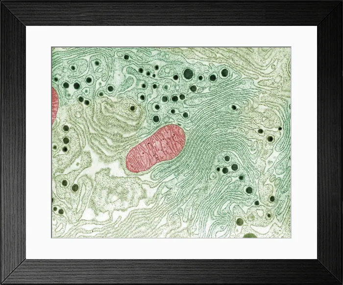 Framed Print : Pancreas, Endoplasmic Reticulum, TEM