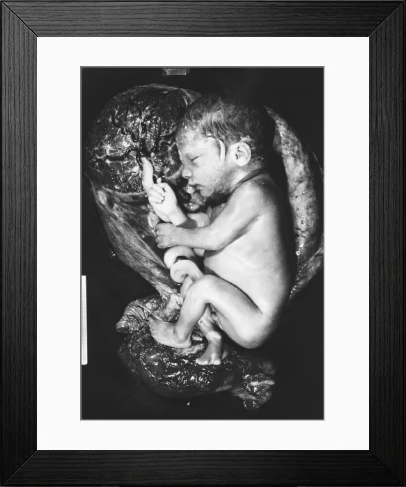 Framed Print : Human fetus Framed Print : Human fetus