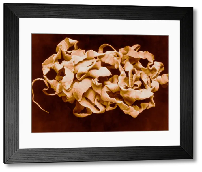Framed Print : Human Tapeworm, gross specimen Framed Print : Human Tapeworm, gross specimen
