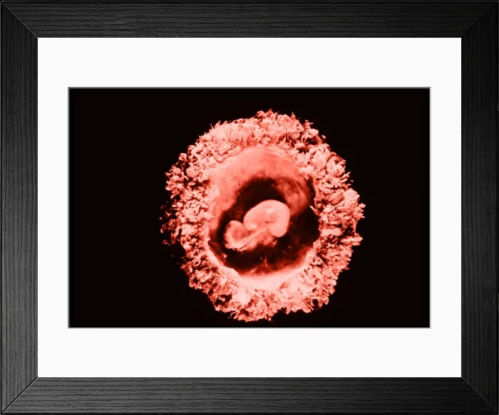Framed Print : Human embryo Framed Print : Human embryo