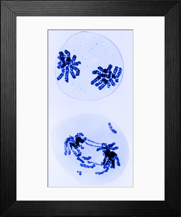 Framed Print : Chromosomes, Radiation Damage, TEM Framed Print : Chromosomes, Radiation Damage, TEM