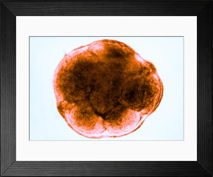 Framed Print : Human Reproduction, Ovum, 8-Cell Stage, light micrograph Framed Print : Human Reproduction, Ovum, 8-Cell Stage, light micrograph