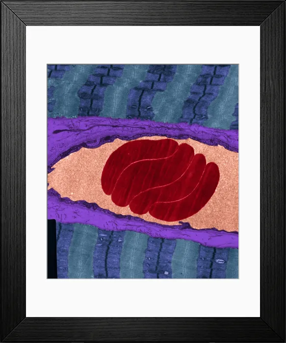 Framed Print : Erythrocytes, Capillary, Muscle Fibers, TEM