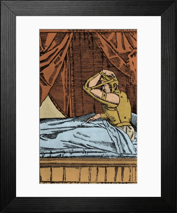 Framed Print : Tagliacozzi's Method of Growing New Nose from Arm Skin Framed Print : Tagliacozzi's Method of Growing New Nose from Arm Skin