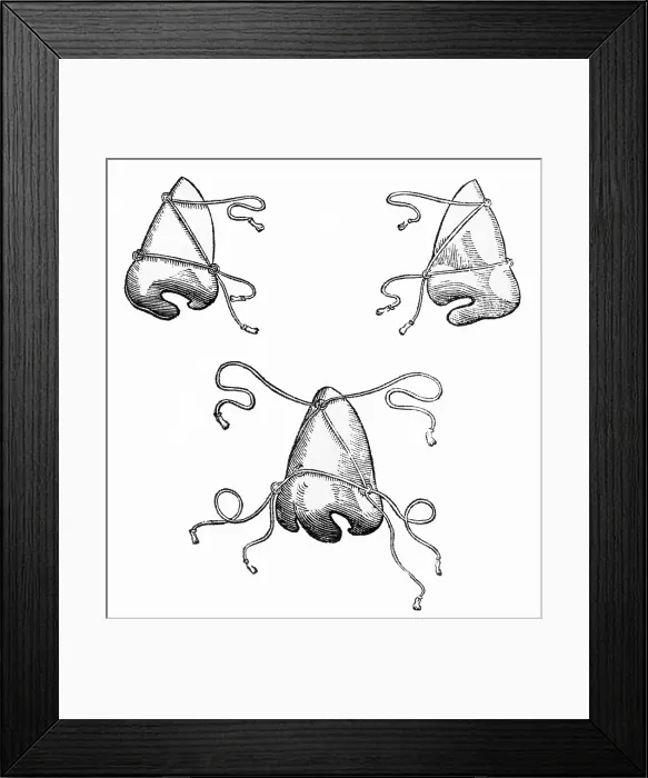Framed Print : Tagliacozzi's Post-Operative Nose Masks, 1500s