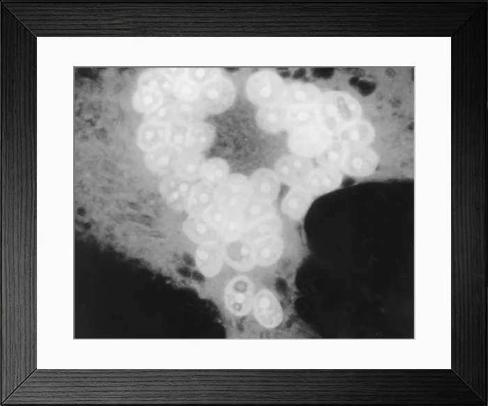 Framed Print : MeV, Measles Virus, TEM Framed Print : MeV, Measles Virus, TEM