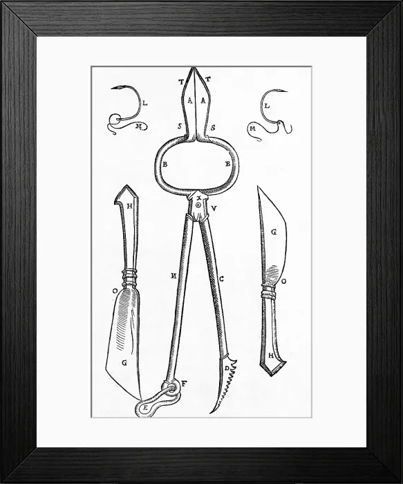 Framed Print : Equipment for One of Tagliacozzi's Rhinoplasty Methods Framed Print : Equipment for One of Tagliacozzi's Rhinoplasty Methods