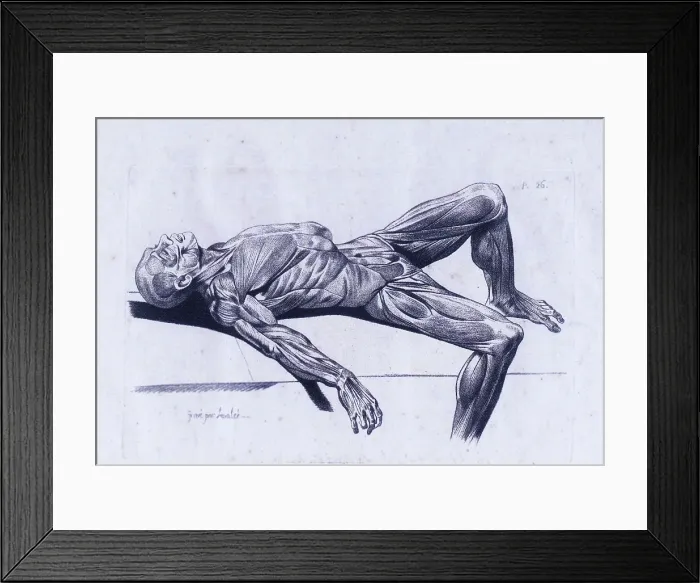 Framed Print : A flayed cadaver Framed Print : A flayed cadaver