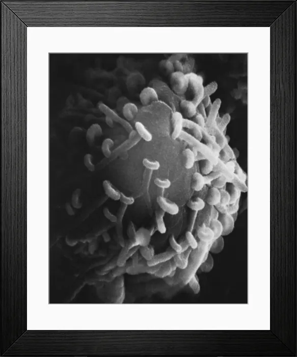 Framed Print : Motor Nerve, Synapses, under a microscope (SEM) Framed Print : Motor Nerve, Synapses, under a microscope (SEM)