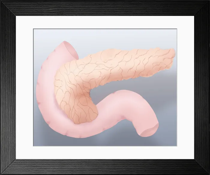 Framed Print : Pancreas Illustration