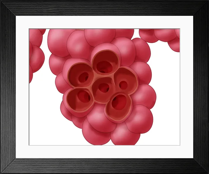 Framed Print : Alveoli. Illustration of alveoli, the small air sacs at the end of the respiratory tree 