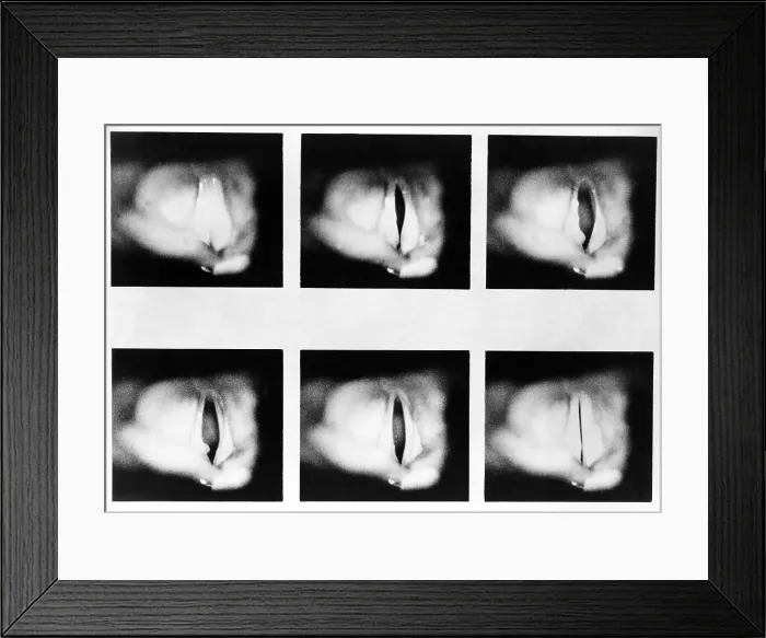Framed Print : Vocal Chords Framed Print : Vocal Chords