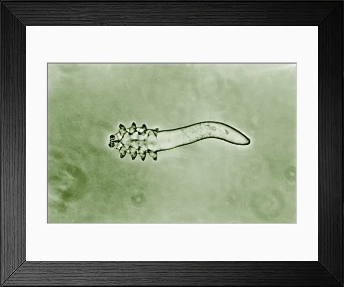 Framed Print : Hair follicle mite Framed Print : Hair follicle mite