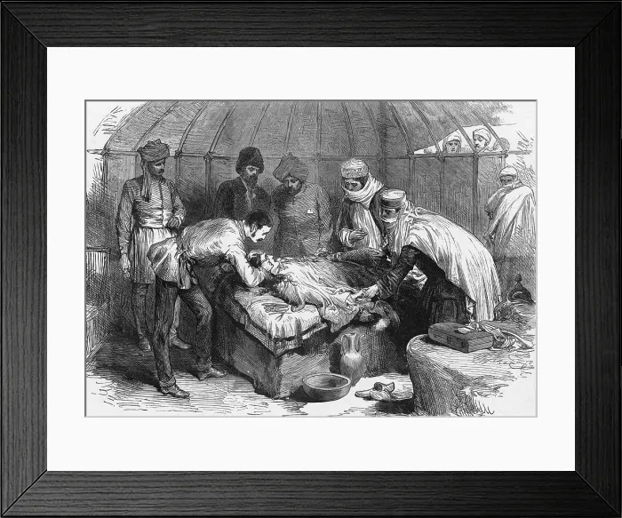 Framed Print : Burn Surgery, 1885 Framed Print : Burn Surgery, 1885