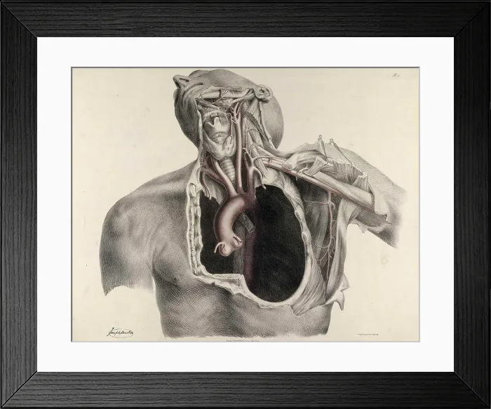 Framed Print : Historical Anatomical Illustration Framed Print : Historical Anatomical Illustration