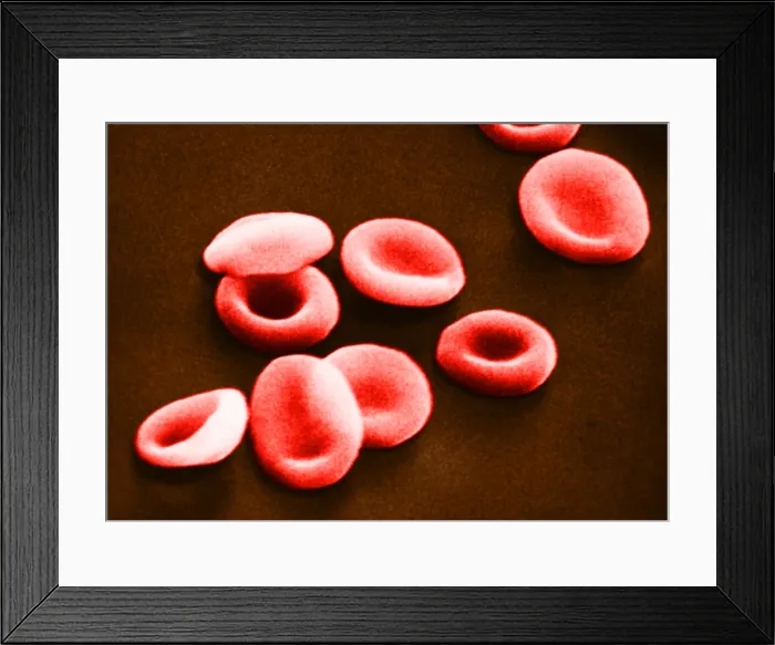 Framed Print : Red Blood Cells, under a microscope (SEM) Framed Print : Red Blood Cells, under a microscope (SEM)