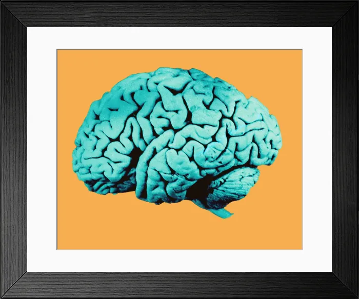 Framed Print : Human Brain Framed Print : Human Brain